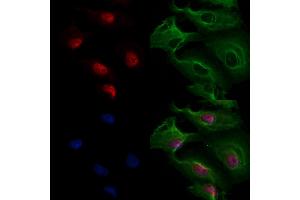 ABIN6265848 and ABIN6277175 staining  cells by IF/ICC. (UBE2I anticorps  (N-Term))