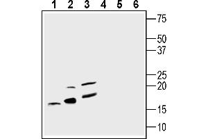 Western blot analysis of rat spleen lysate (lanes 1 and 4), mouse spleen membranes (lanes 2 and 5) and mouse  microglia cell line lysate (lanes 3 and 6): 1-3.
