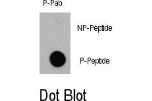 Image no. 1 for anti-Eukaryotic Translation Initiation Factor 4E Binding Protein 1 (EIF4EBP1) (pThr36) antibody (ABIN358355) (eIF4EBP1 anticorps  (pThr36))