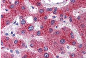 Human Liver: Formalin-Fixed, Paraffin-Embedded (FFPE)