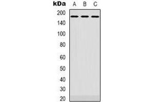 Western blot analysis of EGFR expression in Hela (A), SKOV3 (B), A431 (C) whole cell lysates. (EGFR anticorps  (C-Term))