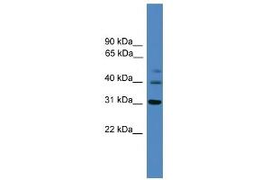 WB Suggested Anti-TRIB1 Antibody Titration: 0. (TRIB1 anticorps  (C-Term))