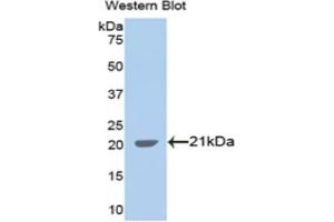 Detection of Recombinant SPTAN1, Human using Polyclonal Antibody to Alpha-Fodrin (SPTAN1) (SPTAN1 anticorps  (AA 1573-1742))