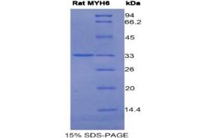 SDS-PAGE of Protein Standard from the Kit (Highly purified E.