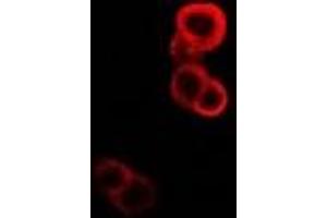 Immunofluorescent analysis of GABARAP staining in MCF7 cells. (GABARAP anticorps)