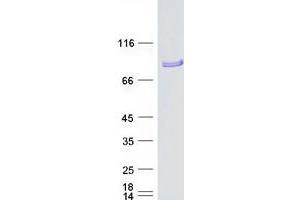 Validation with Western Blot