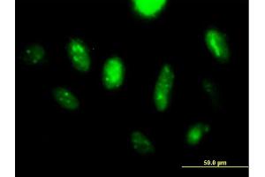 Immunofluorescence of purified MaxPab antibody to LANCL2 on HeLa cell.