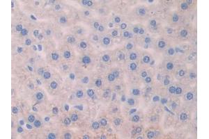 IHC-P analysis of Mouse Liver Tissue, with DAB staining. (AGGF1 anticorps  (AA 263-507))