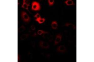 Immunofluorescent analysis of RANBP5 staining in Hela cells.