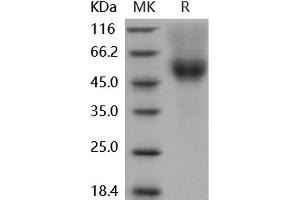 Western Blotting (WB) image for Fc Receptor, IgG, High Affinity I (FCGR1) (Active) protein (Biotin,His-Avi Tag) (ABIN7320414)