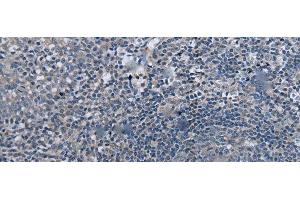 Immunohistochemistry of paraffin-embedded Human tonsil tissue using UBR4 Polyclonal Antibody at dilution of 1:55(x200)