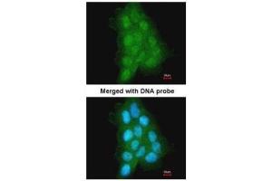 ICC/IF Image Immunofluorescence analysis of paraformaldehyde-fixed A431, using MAGEA11, antibody at 1:500 dilution.