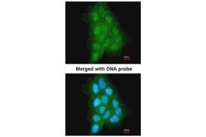 ICC/IF Image Immunofluorescence analysis of paraformaldehyde-fixed A431, using MAGEA11, antibody at 1:500 dilution. (MAGEA11 anticorps  (N-Term))