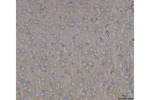 IHC analysis of ADAM22 using anti-ADAM22 antibody (ABIN7600714). (ADAM22 anticorps  (AA 223-829))