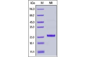 Rhesus macaque / Cynomolgus Complement Factor D, His Tag on  under ing (NR) condition.
