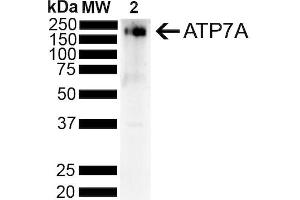 Western Blot analysis of Rat Liver showing detection of ~180 kDa Copper Transporting ATPase 1 protein using Mouse Anti-Copper Transporting ATPase 1 Monoclonal Antibody, Clone S60-4 (ABIN2485193).