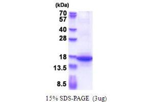 SDS-PAGE (SDS) image for Microfibrillar Associated Protein 3 (MFAP3) (AA 19-147) protein (His tag) (ABIN5853672)