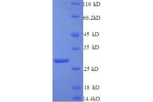 SDS-PAGE (SDS) image for Complement Component 1, Q Subcomponent-Like 1 (C1qL1) (AA 17-258) protein (His tag) (ABIN5713296)