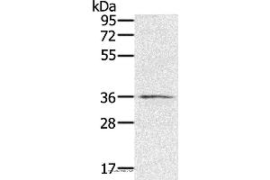 Western blot analysis of TM4 cell, using RNF144B Polyclonal Antibody at dilution of 1:400
