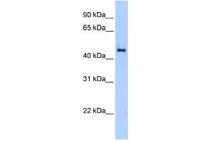 SERPINE1 antibody used at 1 ug/ml to detect target protein. (PAI1 anticorps  (N-Term))