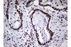 Image no. 21 for anti-Nibrin (NBN) (AA 183-460) antibody (ABIN1491066)