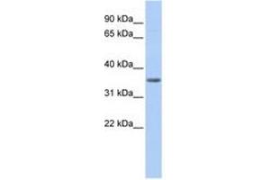 Image no. 1 for anti-Pyruvate Dehydrogenase beta (PDHB) (AA 72-121) antibody (ABIN6741021) (PDHB anticorps  (AA 72-121))