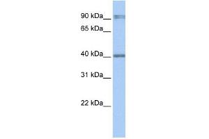 Western Blot showing AIM2 antibody used at a concentration of 1-2 ug/ml to detect its target protein. (AIM2 anticorps  (N-Term))