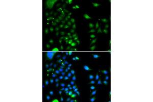 Immunofluorescence analysis of MCF-7 cells using UBE2J2 antibody (ABIN5974418). (UBE2J2 anticorps)