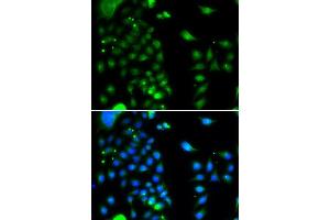 Immunofluorescence analysis of MCF-7 cells using UBE2J2 antibody (ABIN5974418). (UBE2J2 anticorps)