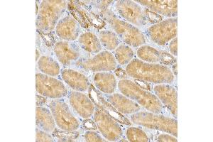 Immunohistochemistry of paraffin-embedded rat kidney using CLIC4 Rabbit pAb (ABIN6127638, ABIN6138723, ABIN6138724 and ABIN6222890) at dilution of 1:50 (40x lens).