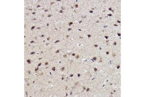 Immunohistochemistry of paraffin-embedded mouse brain using  Rabbit mAb (ABIN7265552) at dilution of 1:100 (40x lens).
