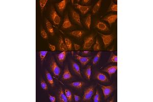 Immunofluorescence analysis of U-2 OS cells using PGE Receptor EP2 (PGE Receptor EP2 (PGE receptor EP2 (PTGER2))) Rabbit mAb (ABIN7269572) at dilution of 1:100 (40x lens).