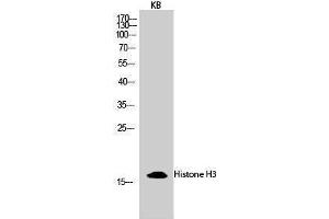 Western Blotting (WB) image for anti-Histone 3 (H3) (Lys428) antibody (ABIN3180089) (Histone 3 anticorps  (Lys428))