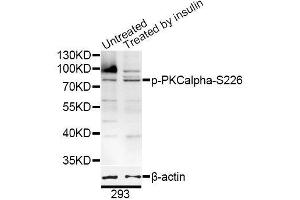 Western blot analysis of extracts of 293 cells, using Phospho-PKCalpha-S226 antibody (ABIN5996200) at 1/1000 dilution.