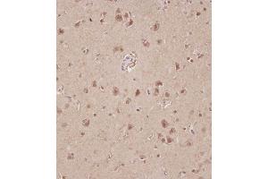 Immunohistochemical analysis of C on paraffin-embedded Human brain tissue.