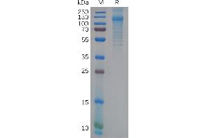 Human F Protein, His Tag on SDS-PAGE under reducing condition.