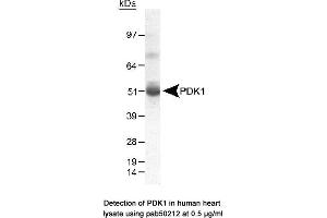 Image no. 1 for anti-Pyruvate Dehydrogenase Kinase (AA 300-400) antibody (ABIN363521) (Pyruvate Dehydrogenase Kinase (AA 300-400) anticorps)