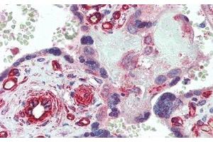 Detection of dLL4 in Human Placenta Tissue using Polyclonal Antibody to Delta Like Protein 4 (dLL4)