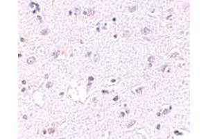 Immunohistochemical staining of human brain tissue with 2. (LASS5 anticorps  (N-Term))