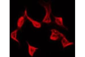 ABIN6278625 staining COLO205 by IF/ICC.