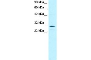 WB Suggested Anti-OTX2 Antibody Titration:  0. (OTX2 anticorps  (N-Term))