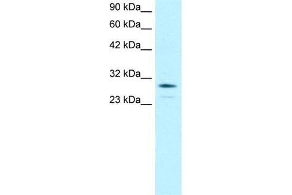 OTX2 anticorps  (N-Term)