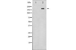 Western blot analysis of HER4 expression in whole cell lysates,The lane on the left is treated with the antigen-specific peptide.