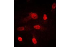Immunofluorescent analysis of SGK1/2 staining in HeLa cells. (SGK1/2 (Center) anticorps)