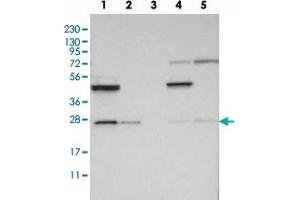 Western blot analysis of Lane 1: RT-4, Lane 2: U-251 MG, Lane 3: Human Plasma, Lane 4: Liver, Lane 5: Tonsil with RP5-1000E10. (SIKE1 anticorps)