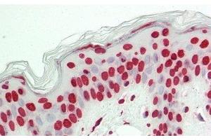 Detection of H3 in Human Skin Tissue using Polyclonal Antibody to Histone H3 (H3)