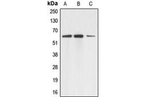 Western blot analysis of Adracalin expression in A431 (A), HEK293T (B), HeLa (C) whole cell lysates. (Adracalin anticorps  (C-Term))