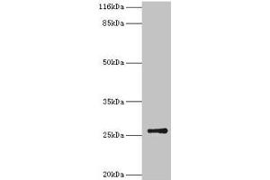 Western blot All lanes: TK1 antibody at 2 μg/mL + CEM whole cell lysate Secondary Goat polyclonal to rabbit IgG at 1/10000 dilution Predicted band size: 26 kDa Observed band size: 26 kDa (TK1 anticorps  (AA 2-234))