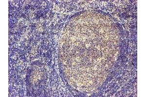 Immunohistochemical staining of paraffin-embedded Human tonsil using anti-MAGEB18 mouse monoclonal antibody. (MAGEB18 anticorps)