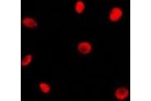 Immunofluorescent analysis of RAD21 staining in Jurkat cells. (RAD21 anticorps  (C-Term))